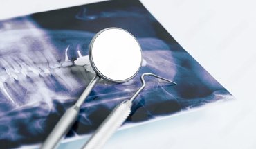 Oral and Maxillofacial Surgery